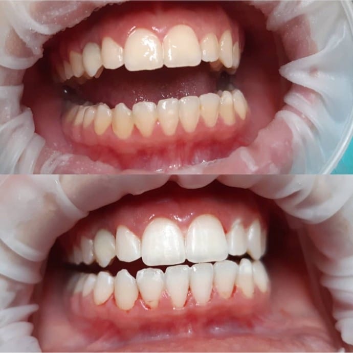 Dentálna hygiena Dentálna hygiena