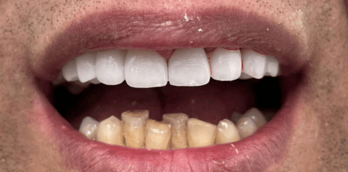 Nov&yacute; &uacute;smev, nov&yacute; začiatok